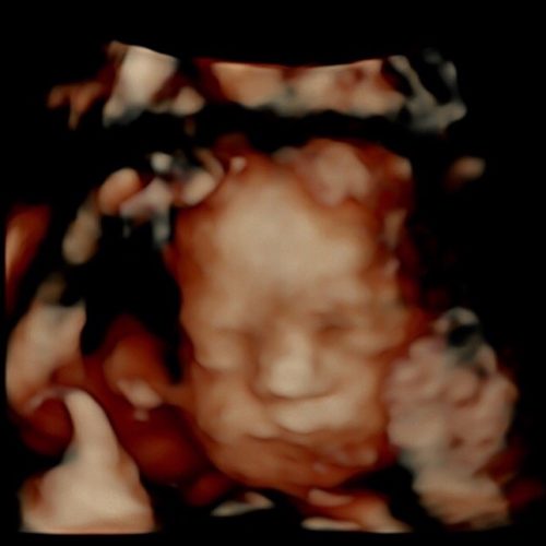 Window to the Womb, Milton Keynes